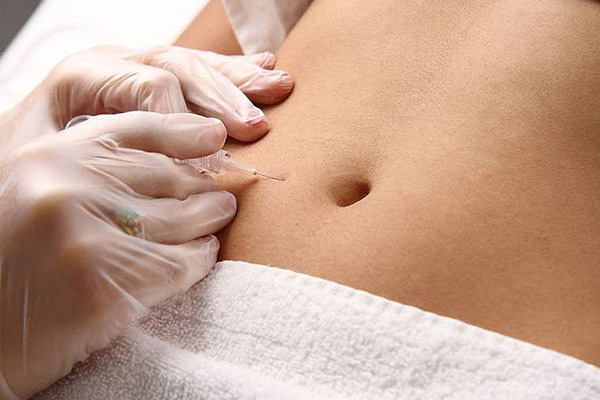 mesoterapia