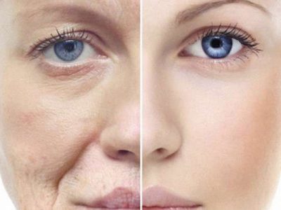 antiaging